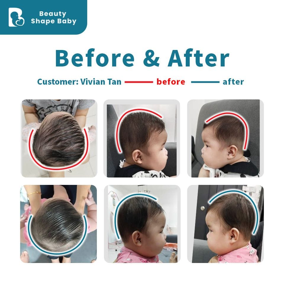 Customer photo review of BSB Head Shaping Pillow ( Upgrade.Ver )