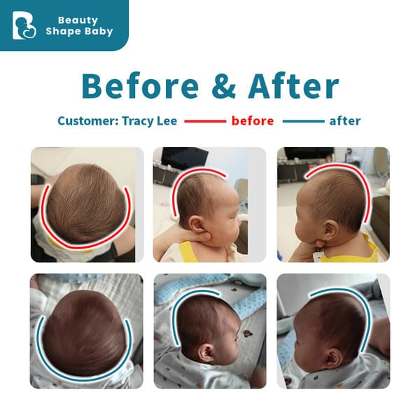 Customer photo review of BSB Head Shaping Pillow ( Upgrade.Ver )