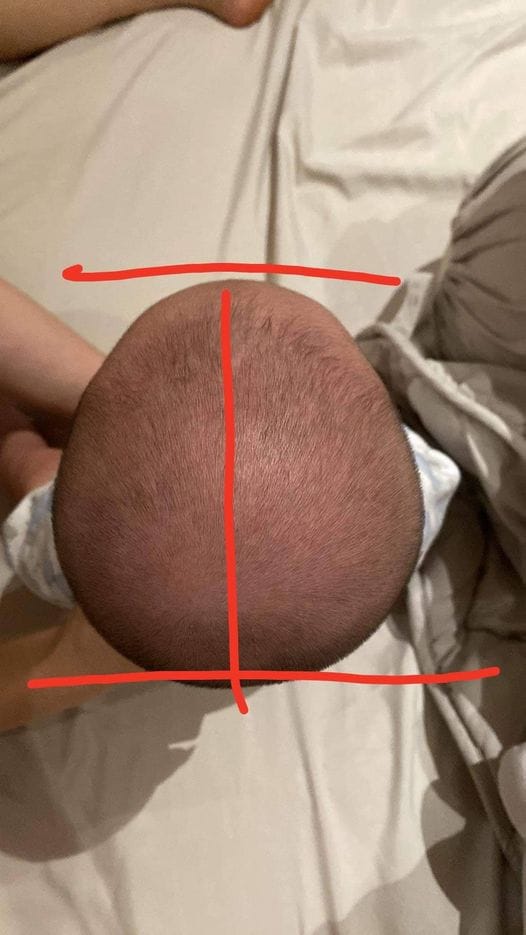 Customer photo review of BSB Head Shaping Pillow ( Upgrade.Ver )