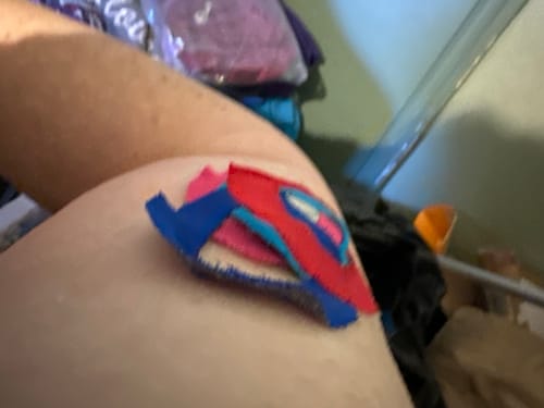 Customer photo review of Skin Grip Original - Dexcom G7 Adhesive Patches (With Cutout)