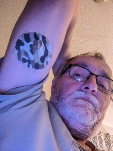 Customer photo review of Skin Grip Original - Dexcom G7 Adhesive Patches