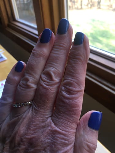 Customer photo review of The Nail Starter Kit