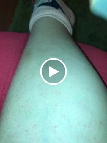 Customer video review of Depilador Nuva Skin®