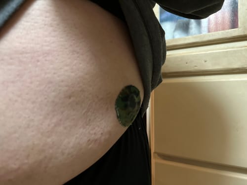 Customer photo review of Skin Grip Original - Dexcom G7 Adhesive Patches