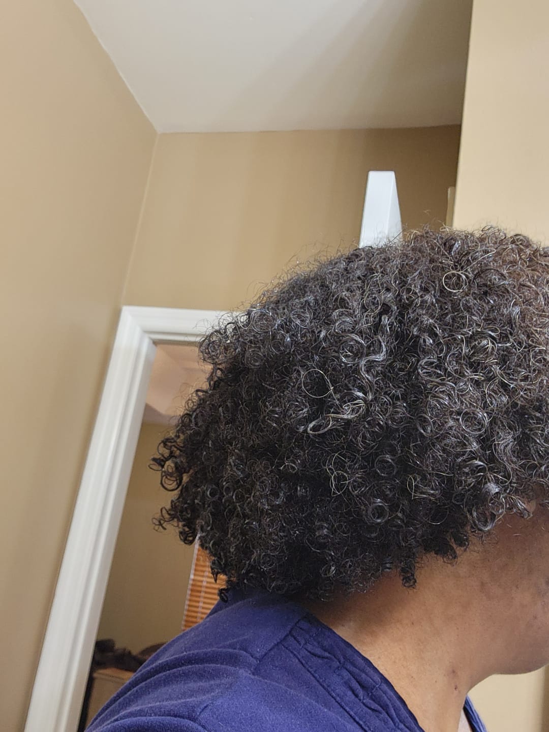Customer photo review of Hair Recovery Bundle
