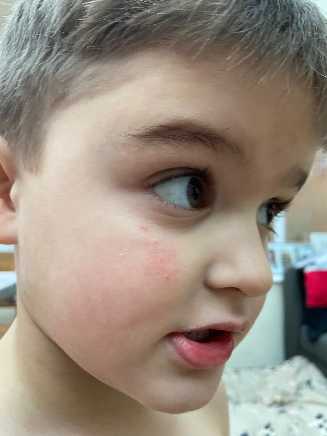 Customer photo review of Bioskin Junior Daily Face Moisturiser