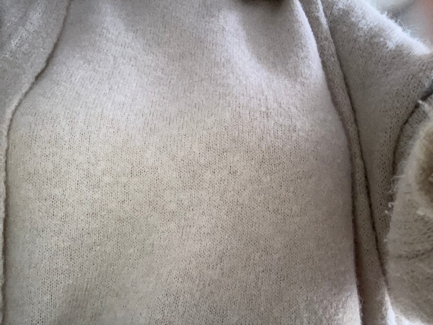 Customer photo review of 4er Mix Pack Nippelcover selbsthaftend + mit Kleber