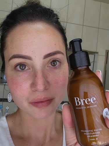 Customer photo review of Probiotic Facial Mist