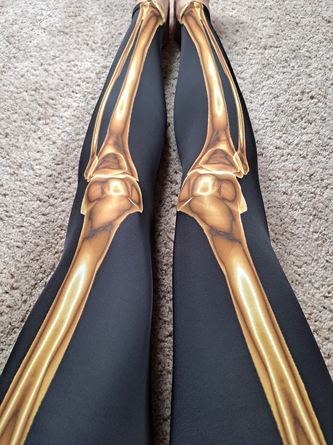 Customer photo review of Golden Skeleton Matching Set
