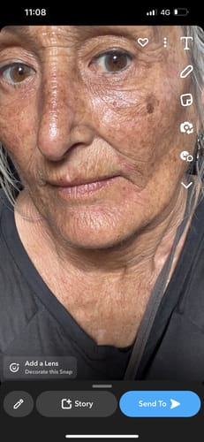 Customer photo review of LOVESKIN Ora Balm