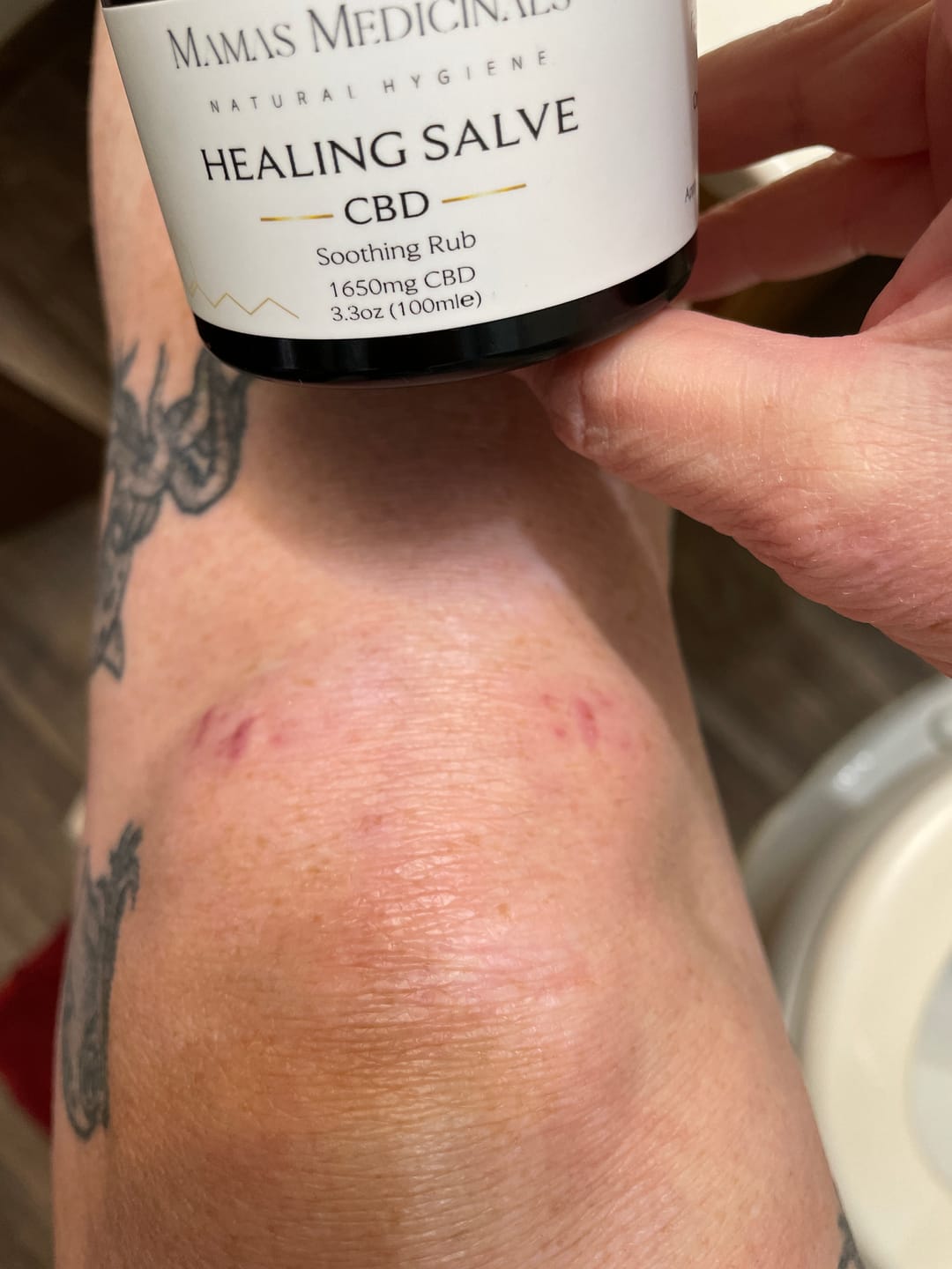 Customer photo review of Healing Salve | CBD