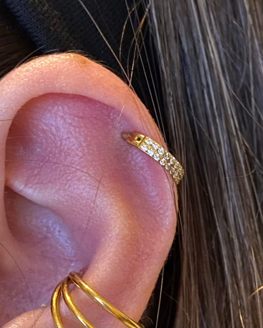 Customer photo review of Double Conch Piercing | Titan