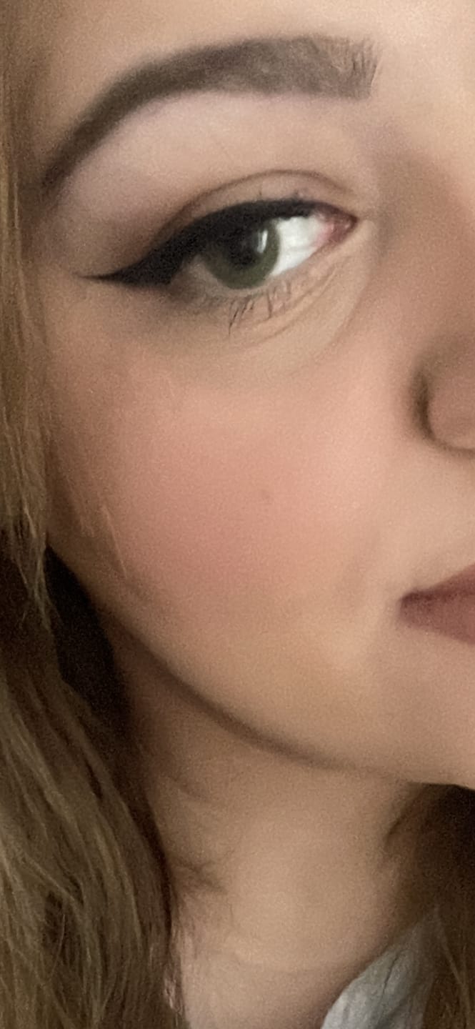 Customer photo review of Allure