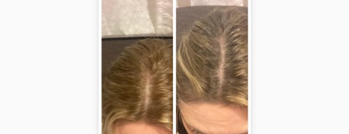 Customer photo review of Sunkissed Refill