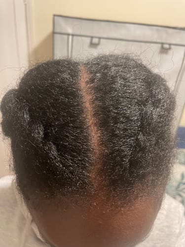 Customer photo review of Roots - Scalp & Beard Serum