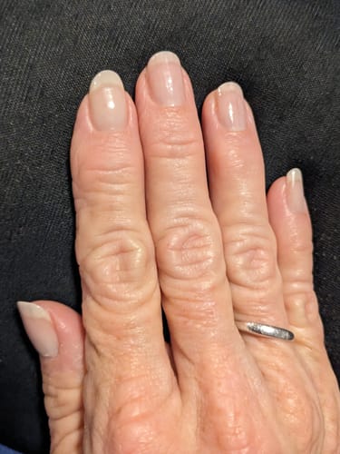 Customer photo review of Conceal & Repair Kit