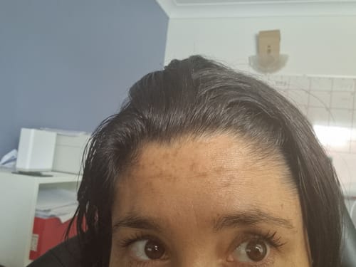 Customer photo review of SEA BUCKTHORN SERUM