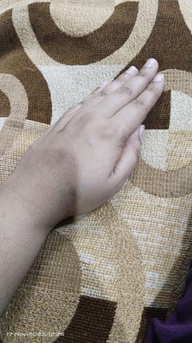 Customer photo review of Skin Rejuvenate - Best Skincare and Skin Glow Supplements