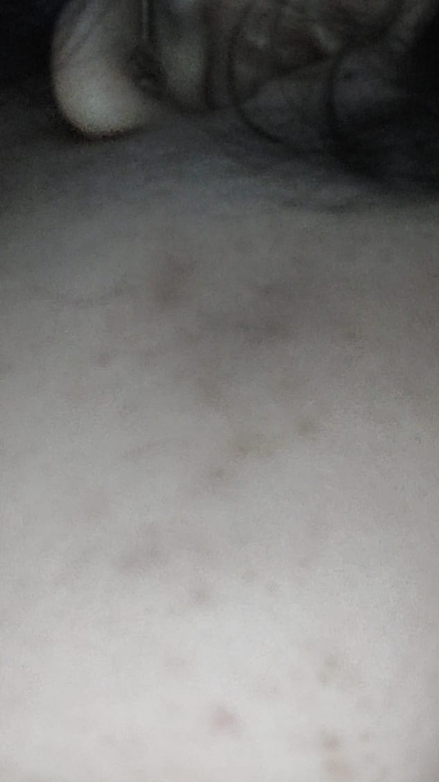 Customer photo review of Tri Melas Cream