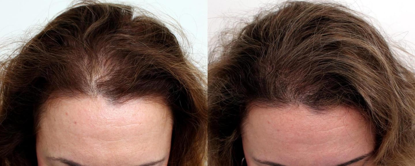 Customer photo review of Bliss™ Collageen Proteine
