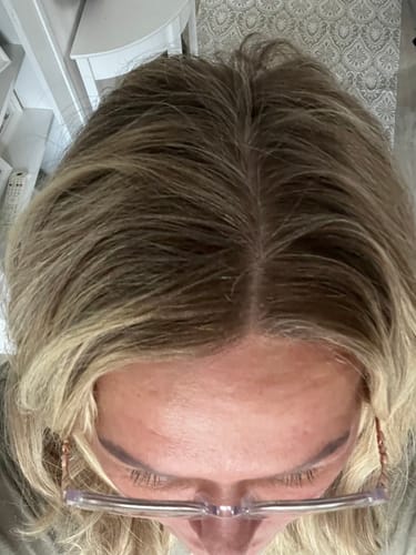 Customer photo review of Sunkissed Starter Kit