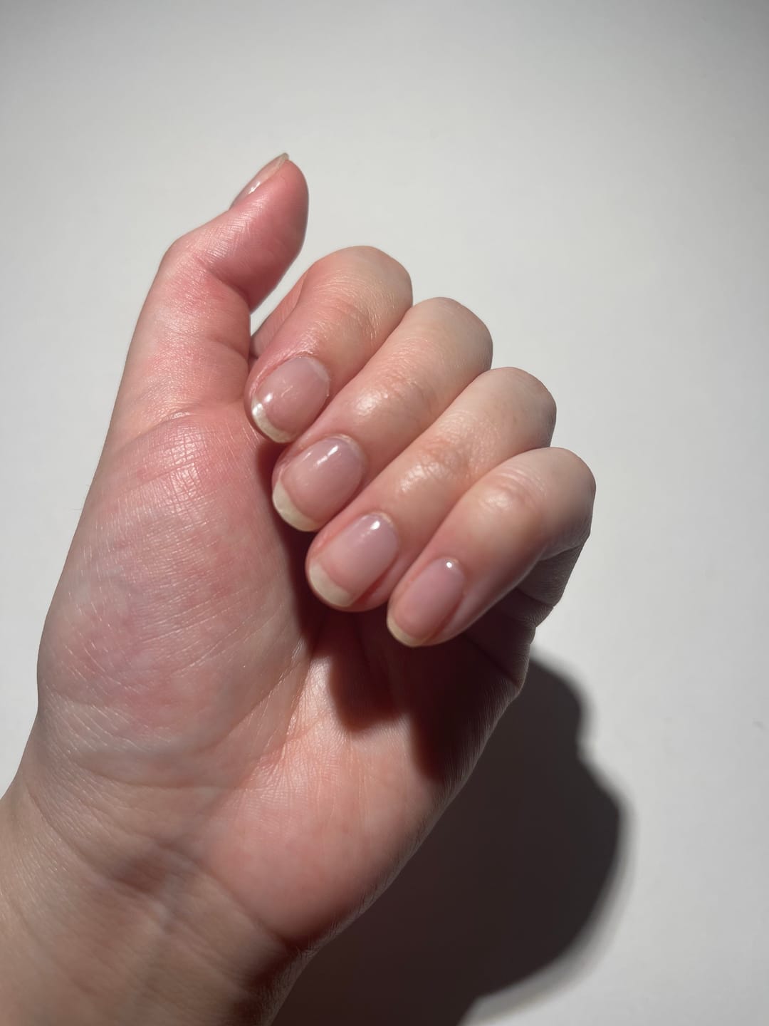Customer photo review of Crystal Clear DIY Semicured Gel Nail Sticker Kit (STOP NAIL BITING & GROW BRITTLE NAILS)