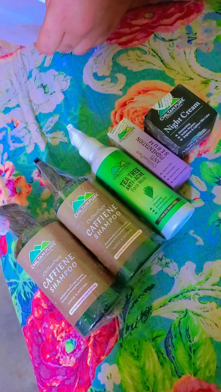 Customer photo review of Anti-Pigmentation Serum – Brighten Skin, Lighten Pigmentation, Fade Freckles & Even Skin Tone 30ml