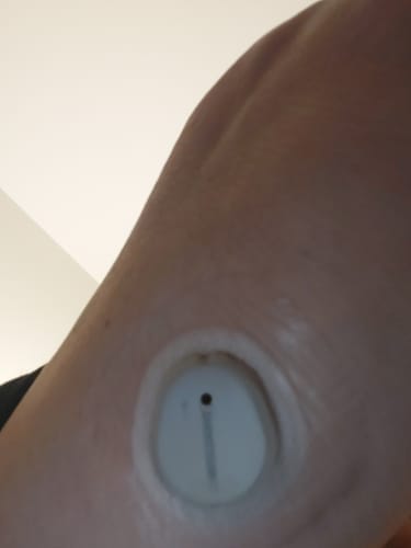 Customer photo review of Skin Grip Original - Dexcom G7 Adhesive Patches (With Cutout)