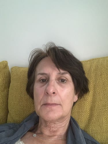 Customer photo review of huile de pépins de figue de barbarie 3 flacon 30ml + 1 flacon offert