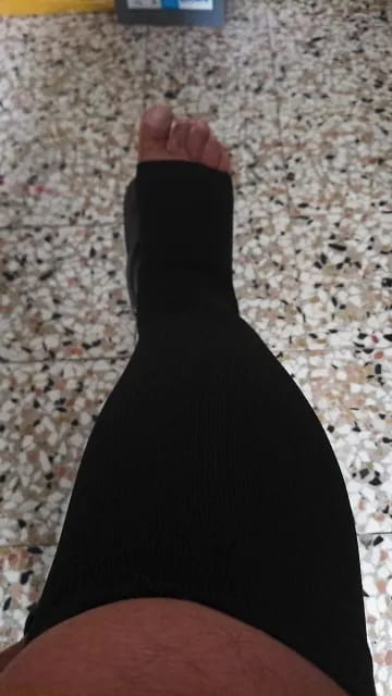 Customer photo review of Chaussettes De Compression Ultra-efficace