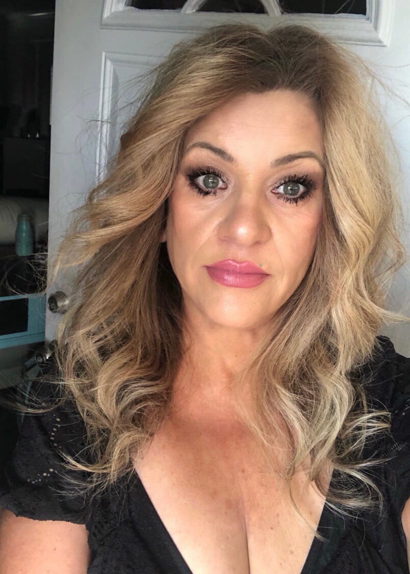 Customer photo review of 14% Jessner Skin Peel (5 ML) 🌿🍃🌱 Everything you need to do a skin peel! 🤩