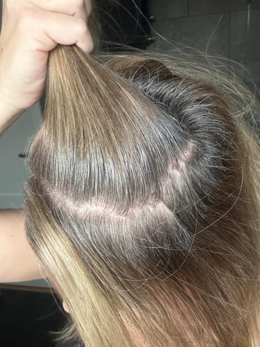 Customer photo review of Sunkissed Starter Kit