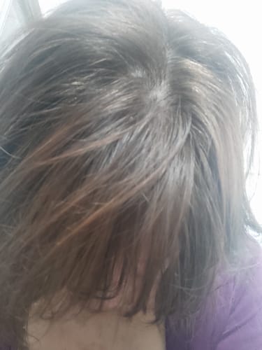 Customer photo review of Loción Anticaída