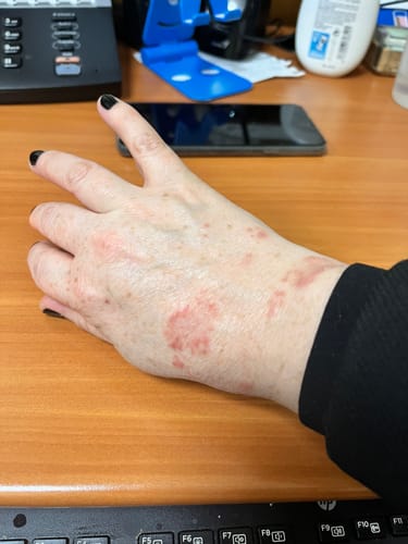 Customer photo review of Emulsión Recuperadora