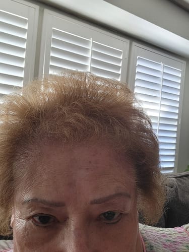 Customer photo review of Ultimate Hair Strength PRO Supplements 90 Days