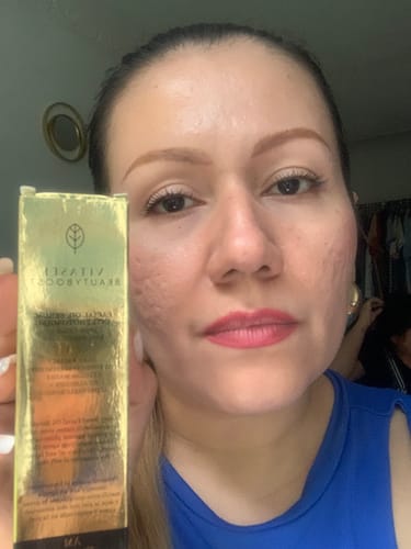 Customer photo review of SERUM FACIAL DÍA CON CÉLULAS MADRE DE ALGODÓN + ÁCIDO HIALURÓNICO