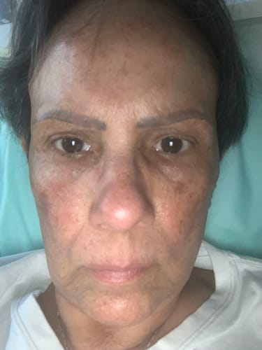 Customer photo review of HYDRO BOOSTER CREMA FACIAL CON 48 HORAS DE HIDRATACIÓN