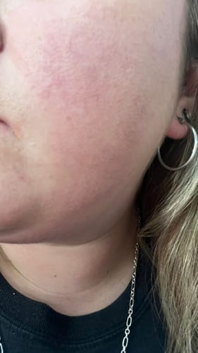 Customer photo review of Emulsión Recuperadora