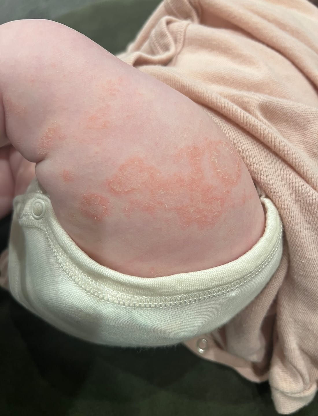 Customer photo review of Baby Cream