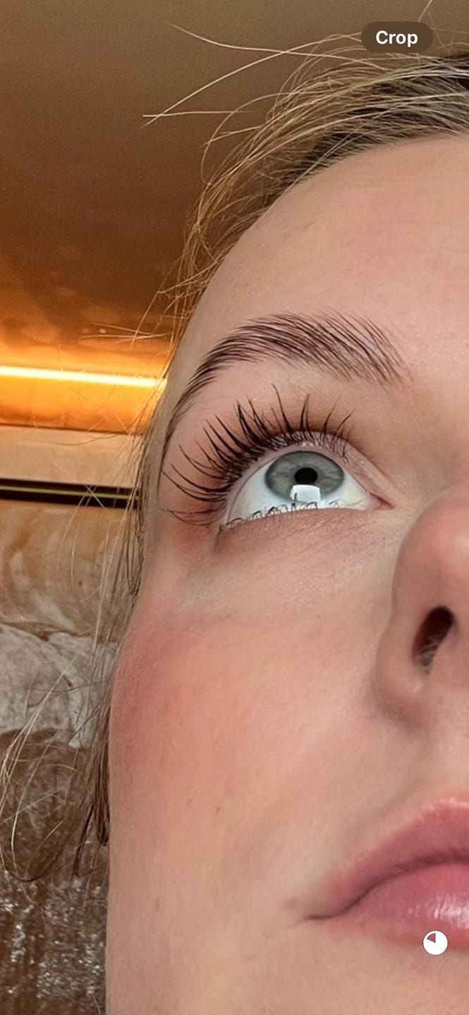 Customer photo review of Eyelash Growth Serum - Original