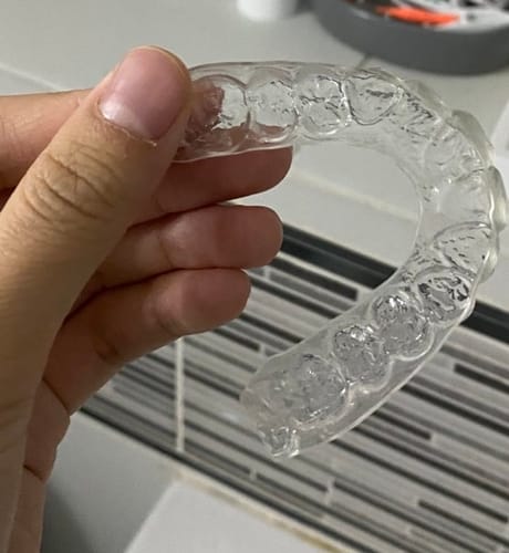 Customer photo review of SleepPro Retainers