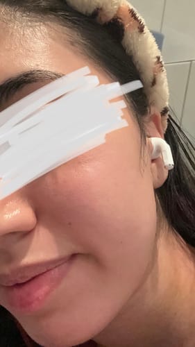 Customer photo review of Salicylsäure BHA 2% 50 ml