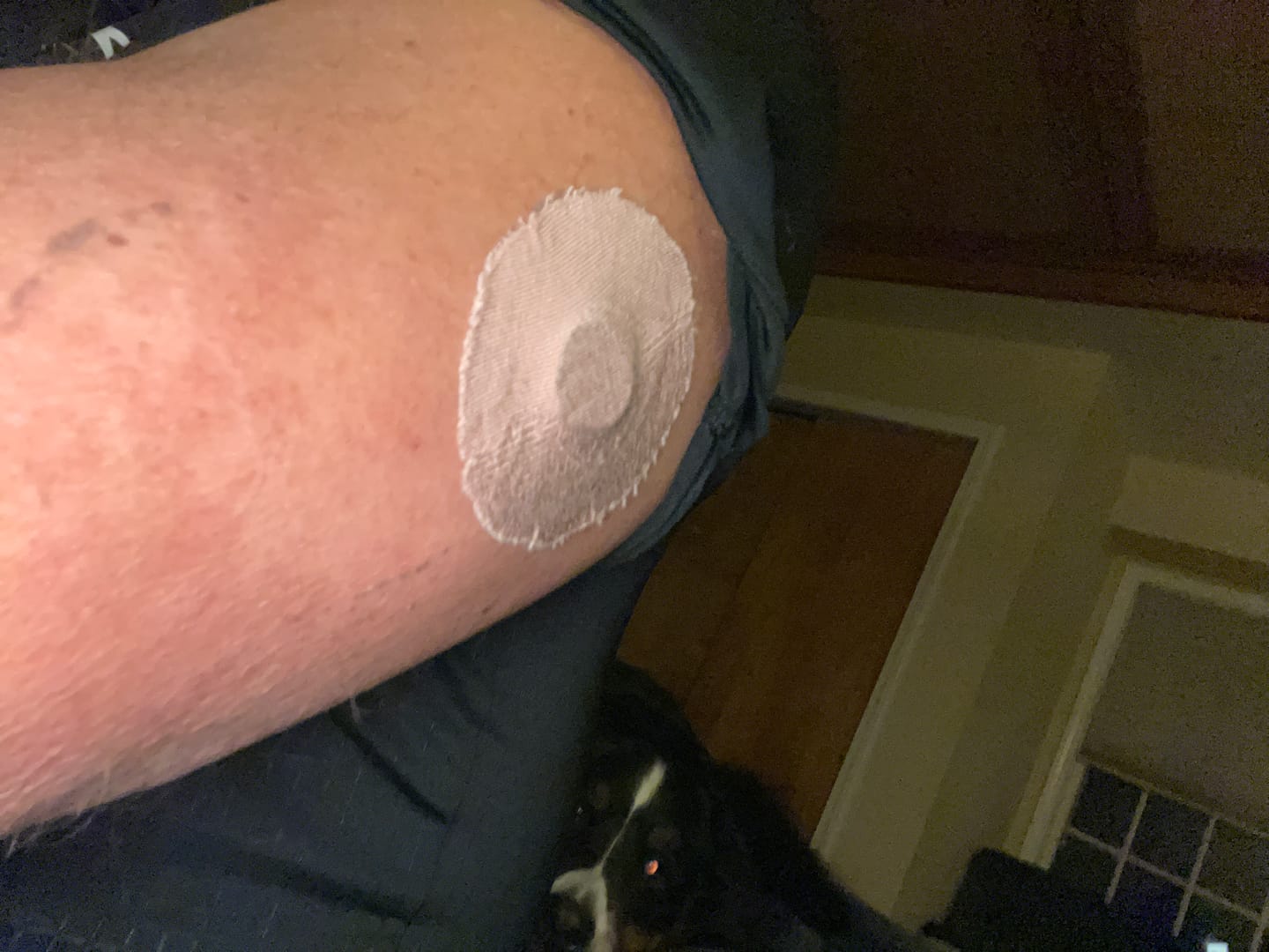 Customer photo review of Skin Grip Original - Dexcom G7 Adhesive Patches