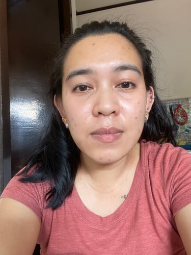 Customer photo review of Bad Skin™ Korean Collagen Bomb Hydrating Ampoule
