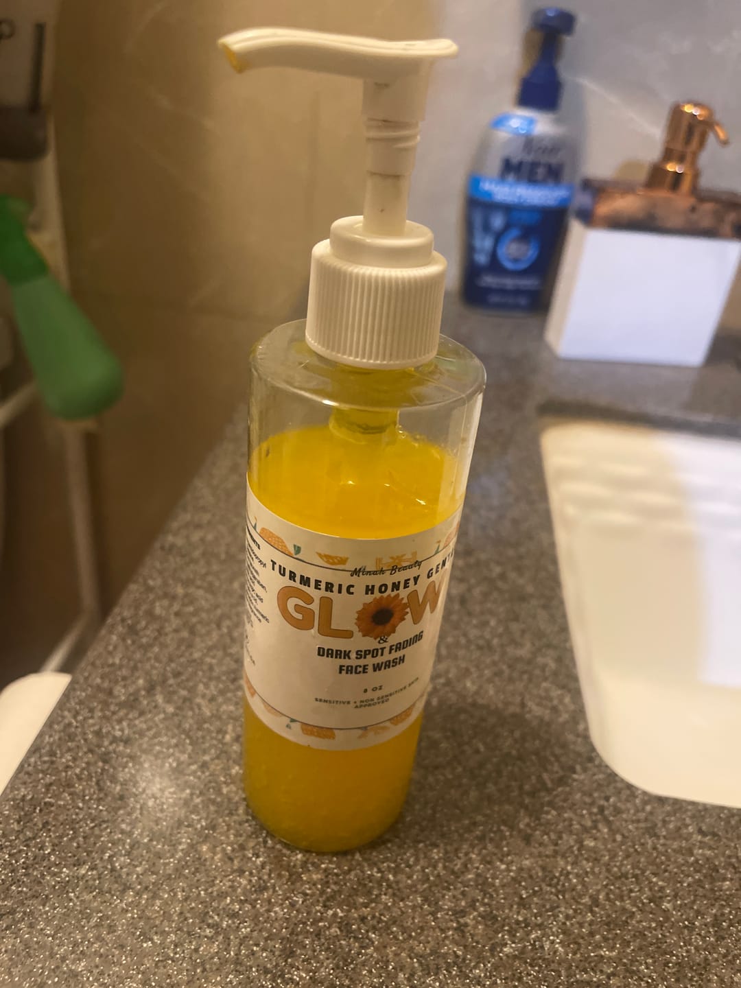 Customer photo review of Turmeric Glow wash for black spots,acne & glow