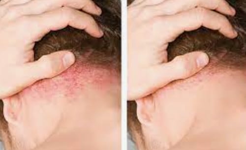 Customer photo review of 10-Day Scalp Care Sample Kit