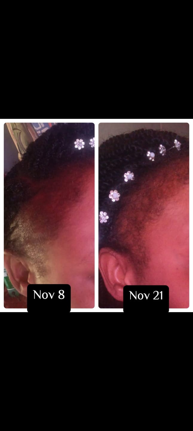 Customer photo review of Fenugreek Hair Spray
