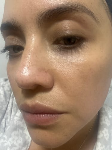 Customer photo review of KIT SUEROS FACIALES DÍA Y NOCHE CON CÉLULAS MADRE, COLÁGENO Y ÁCIDO HIALURÓNICO.