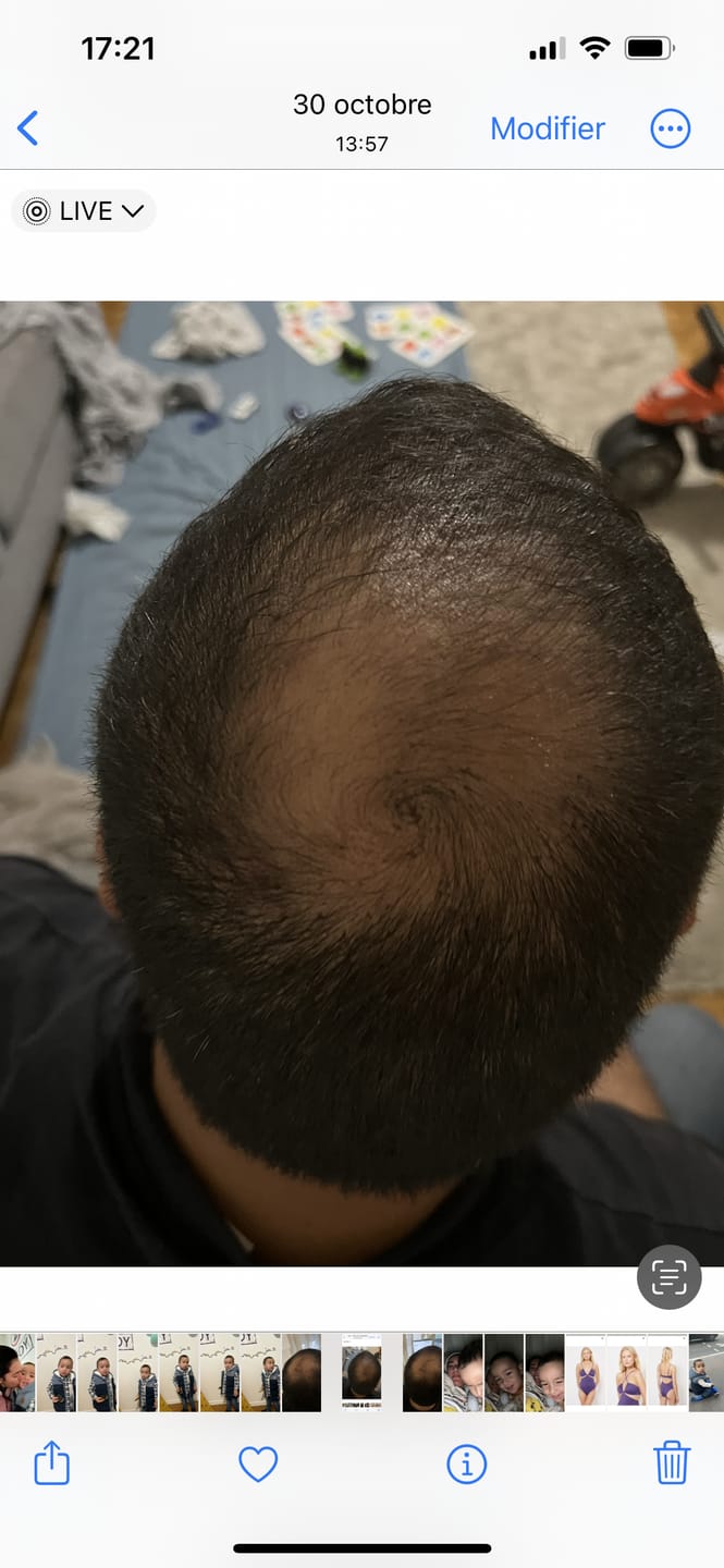 Customer photo review of Good Hair Men Anti-chute homme - 1 mois