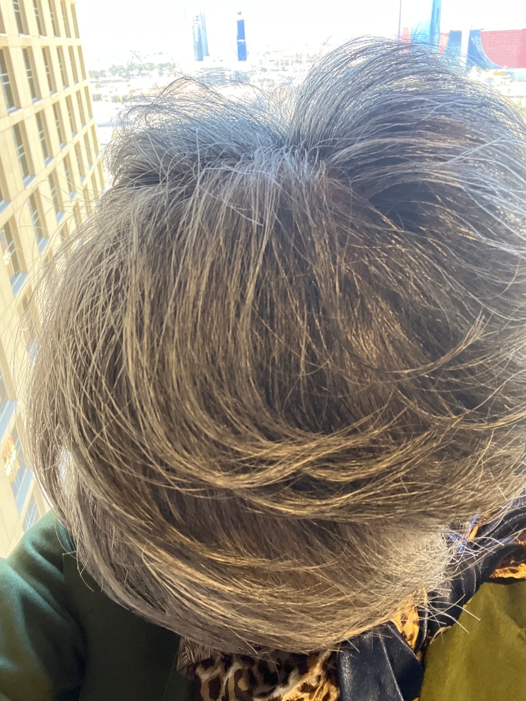 Customer photo review of Neem Oil Shampoo - 6 oz
